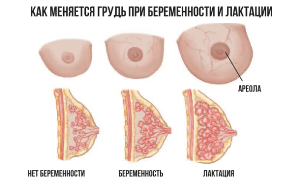 Изменения сосков при беременности и как они выглядят, как правильно ухаживать